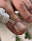 Resultum Onistopix Oil – olejek regenerujący dla paznokci z onycholizą, 8 ml